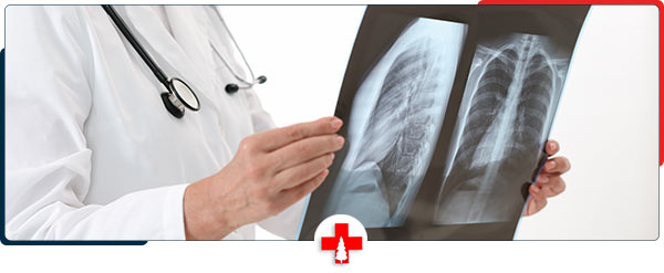 How Much Are X-Rays without Insurance Near Me in Clarkston, MI? How Much Are X-Rays without Insurance Near Me in Clarkston, MI?