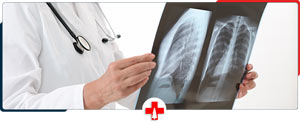 How Much Are X-Rays without Insurance Near Me in Clarkston, MI? How Much Are X-Rays without Insurance Near Me in Clarkston, MI?